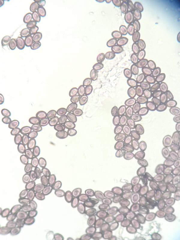 Magic mushroom spores from spore print under microscope